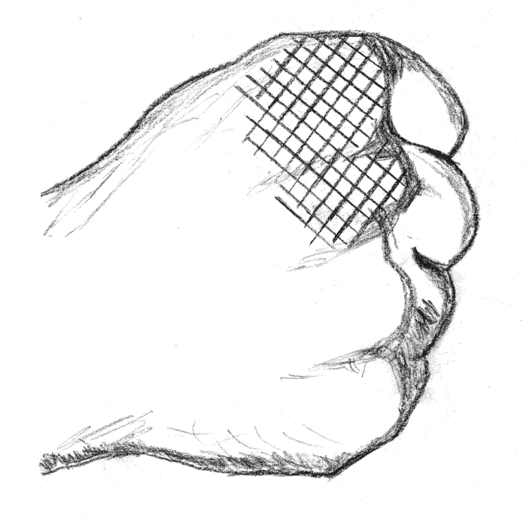 Illustration of a closed fist with the back-fist knuckle area highlighted in red